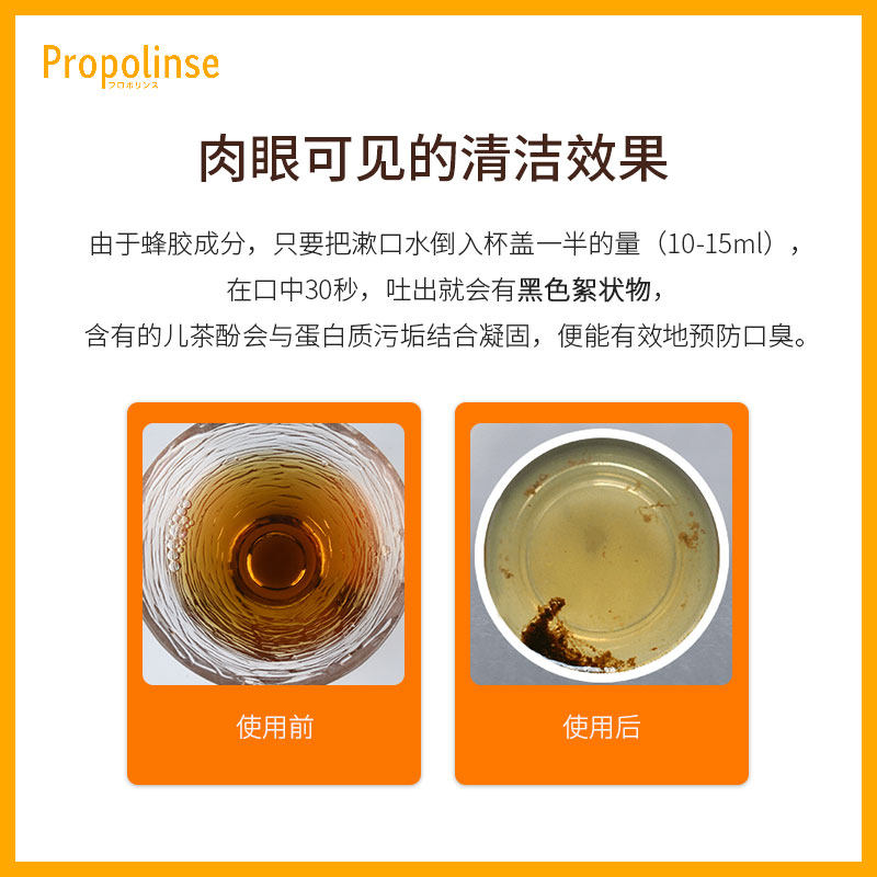 日本比那氏漱口水去牙结石杀菌樱花 Newwind海外漱口水