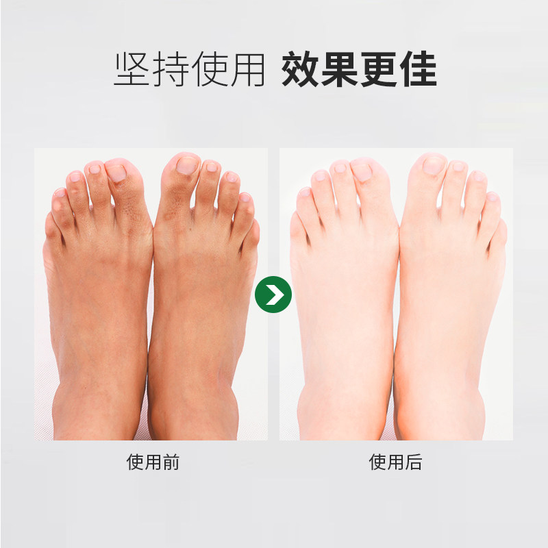 bigly足膜足部去角质保湿滋润脱皮 bigly足膜
