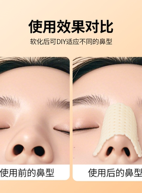热塑鼻夹板自捏塑形防抠鼻矫正
