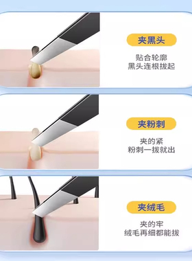 细胞夹去黑头超细镊子高精密粉刺