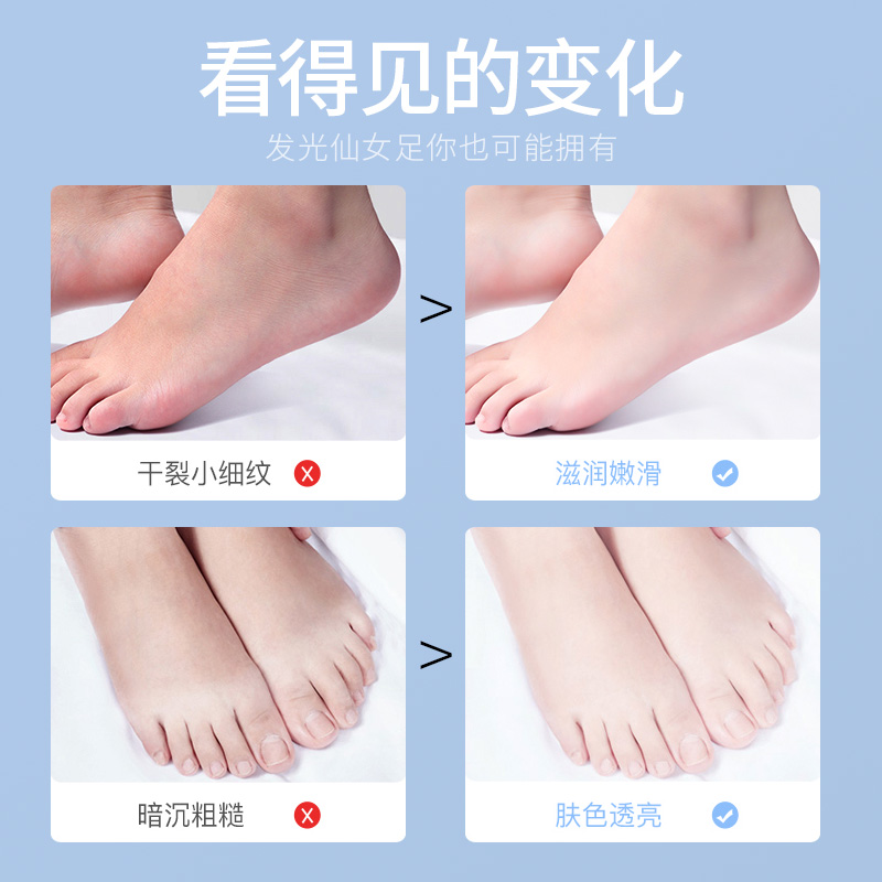 nccu旗舰店香港NCCU凡士林足部40g*5对滋润保湿补水防干裂脚后跟脚膜护理套1