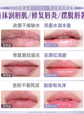 唇部精华润唇膏唇膜女保湿滋润补水防干裂去死皮淡化唇纹官方正品