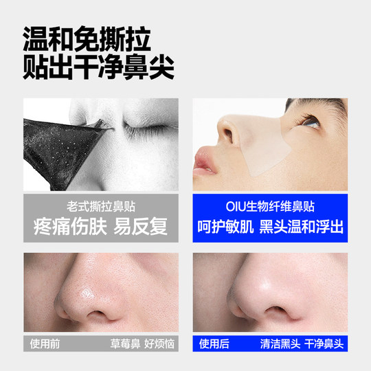 Oiu remove blackheads, shrink pores, black and white head and nose strips
