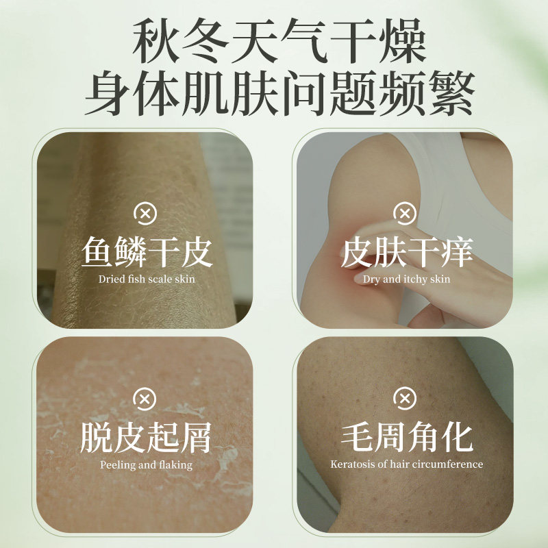 百年扁氏艾草止痒润肤露保湿舒缓止痒全身可用女男士通用