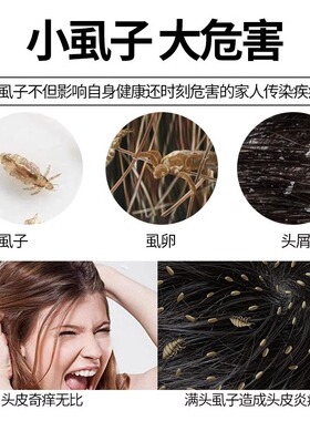 头梳去篦子屑虱子虱卵除头虱加密儿童老式刮头竹篦子超密齿虱子梳