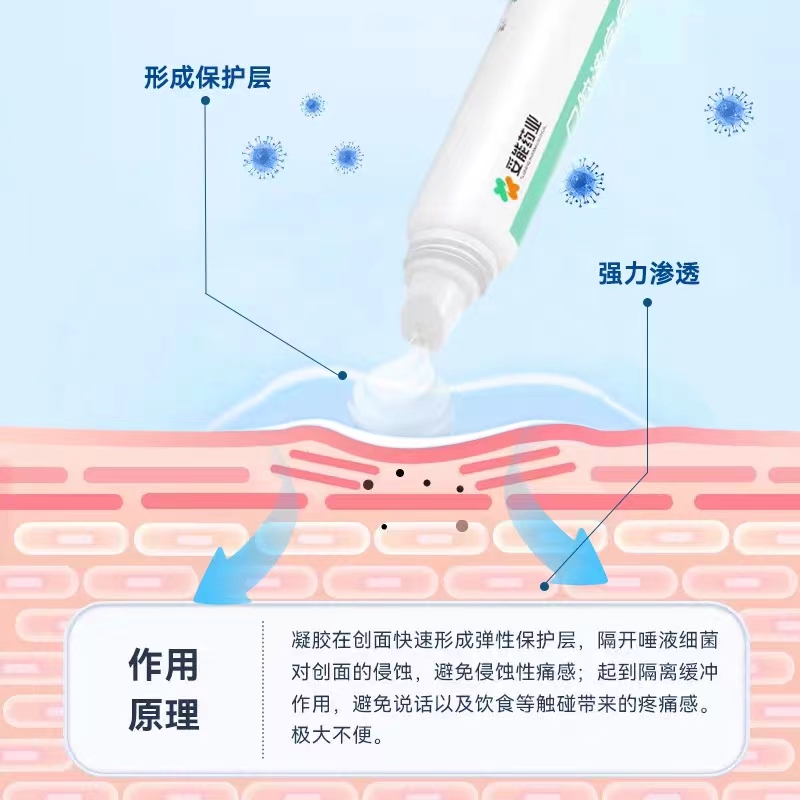 妥能药业口腔溃疡凝胶缓解口腔溃疡上火起泡疼痛药房旗舰正品9zz - 图0