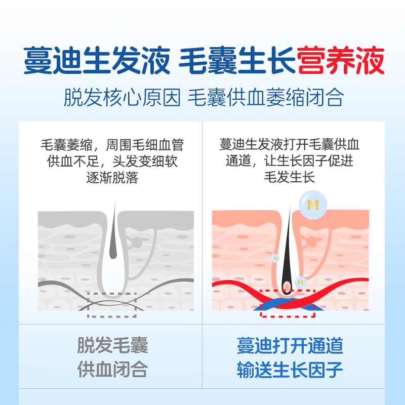 男士固发量贩装蔓迪米诺地尔尓酊生发液育发液男用正品官方旗舰店