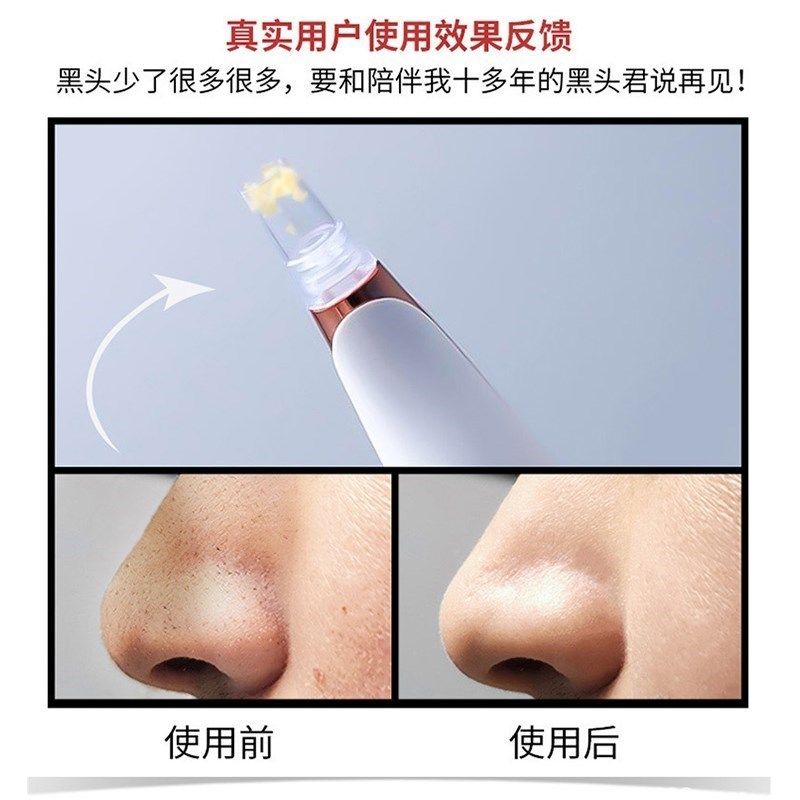 美悟吸黑头神器电动吸毛孔去粉刺清洁吸出器洁面小洗脸气泡美容仪,淘宝优惠券,粉丝福利购,淘宝优惠卷