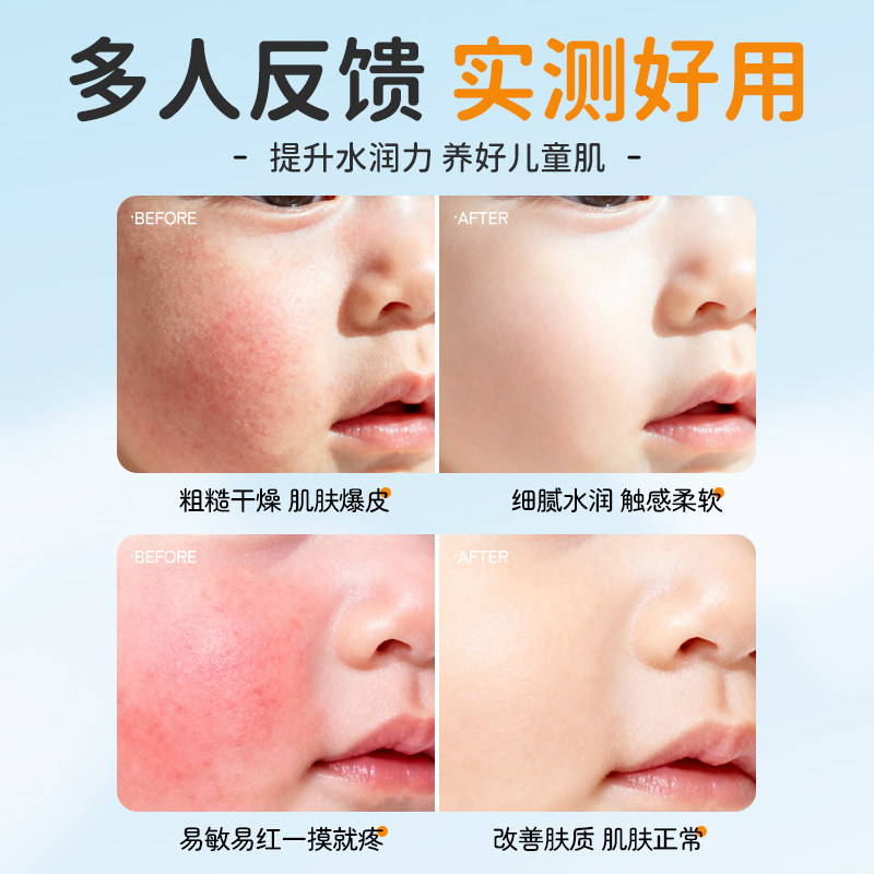 儿童维生素E护肤甘油液补水保湿不黏腻小巧便携式改善干燥滋润,淘宝优惠券,粉丝福利购,淘宝优惠卷