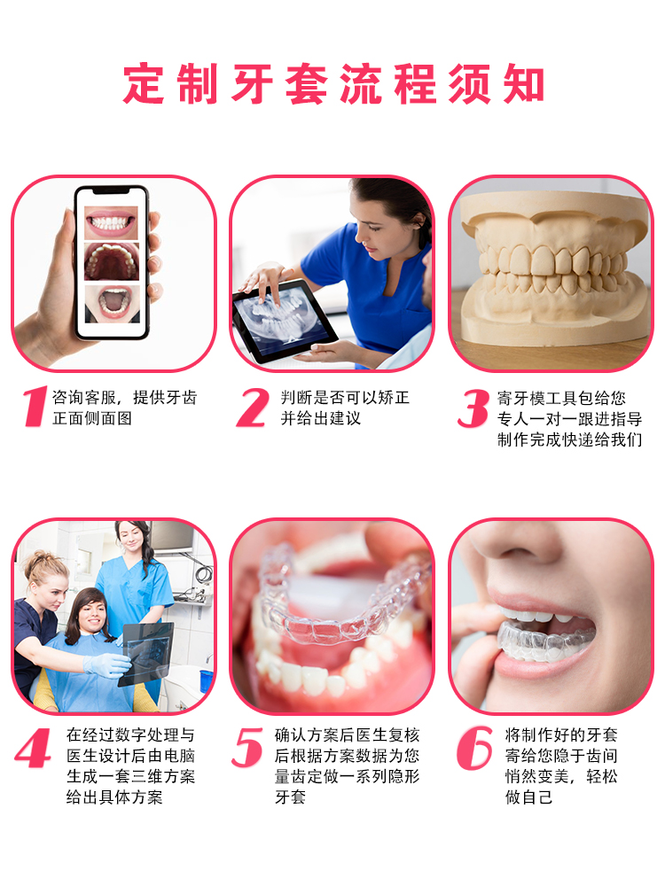 牙齿矫正器隐形透明正畸保持器矫正纠正龅牙缝大整牙隐形牙套定制 - 图0