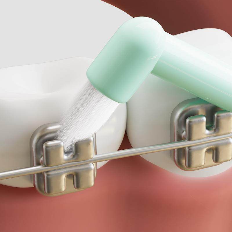 牙缝刷单束尖头牙刷硬毛清洁牙套成人口腔清洁牙间刷个人护理,淘宝优惠券,粉丝福利购,淘宝优惠卷