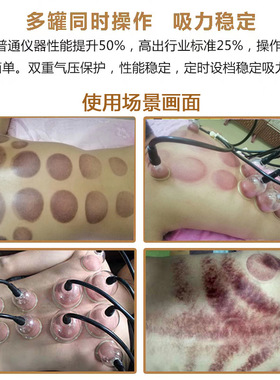 中医养生仪器丰胸仪经络