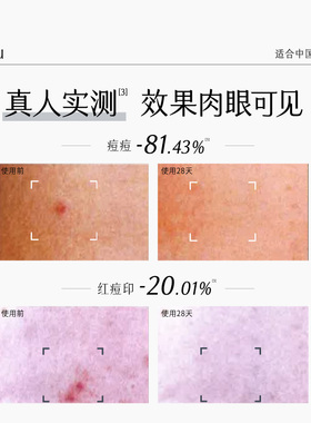 谷雨男士专研控油护肤礼盒