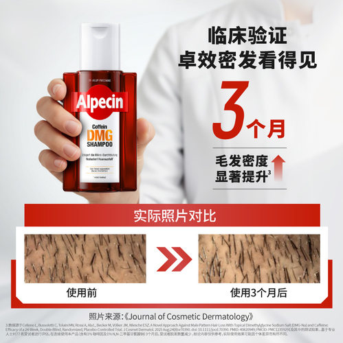 【欧倍青】Alpecin DMG洗发水德国进口咖啡因强韧控油蓬松丰盈 - 图2