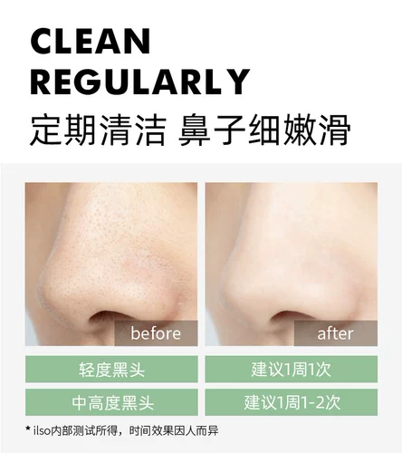 Носовые полоски от черных точек подходит для мужчин и женщин, сужает поры