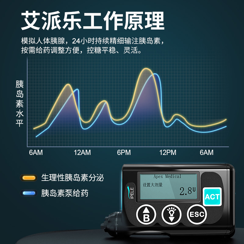 艾派乐胰岛素泵全自动智能家用血糖上门服务精细控糖胰岛素泵便携-图1