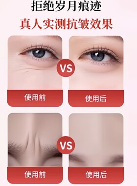 日本川字纹提拉紧致眉间贴