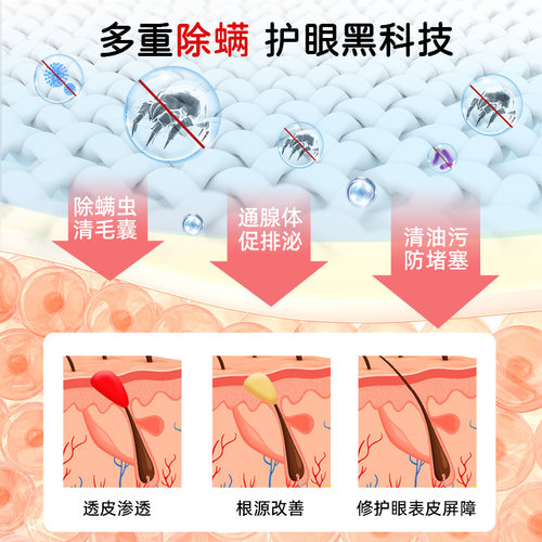 茶树精油除螨湿巾眼睛眼贴眼部螨虫4-松油醇专用眼睑清洁眼 - 图2