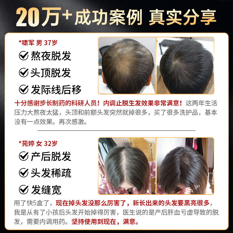 步长荣发胶囊生发增发防油脂溢性脱发斑秃补肝肾养气血男女通用 - 图0