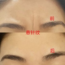 (Small Red Book Recommendation) Farewell to lift the head tattoo The Sichuan character tattoo theorist forehead stickup anti-start-old buy 2 and send 1 ~