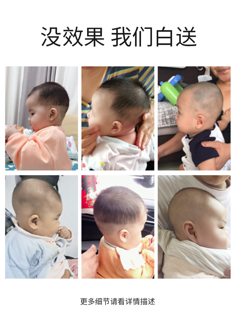 婴儿枕头定型枕防偏头神器纠正扁头 婴乐萌盟婴童枕头/枕芯