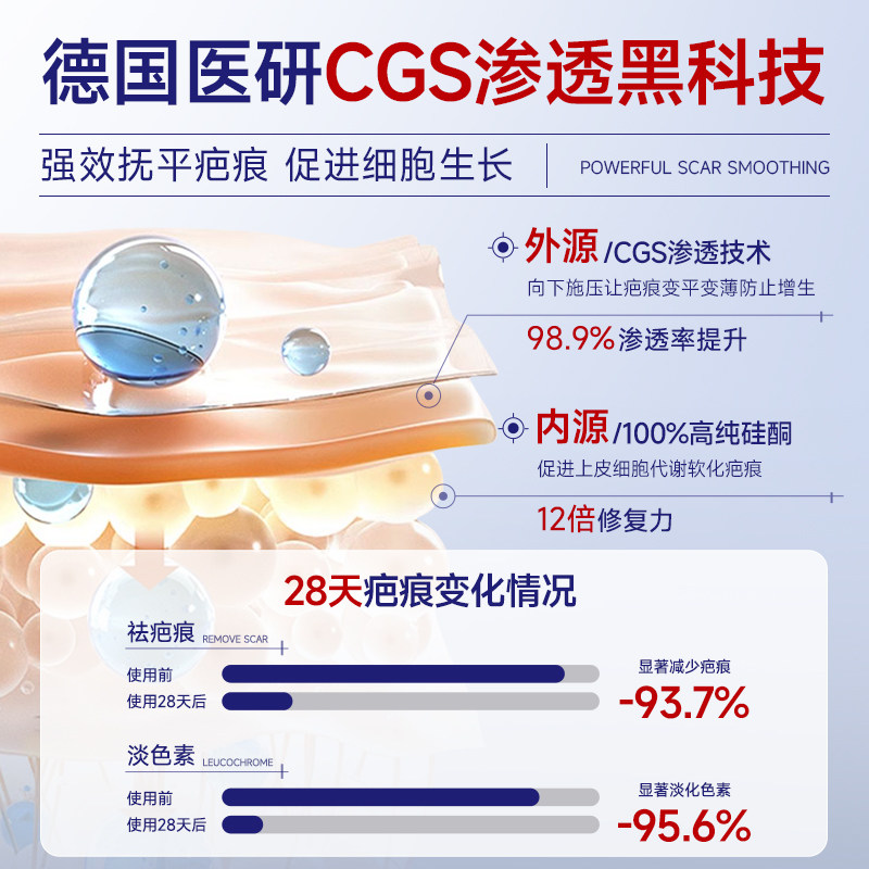 【三甲医用】那复达疤痕贴医用硅酮敷料剖腹产印增生修复除祛疤