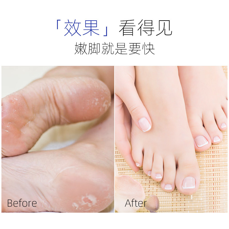 花井田烟酰胺女滋润膜脚膜 花井田足膜