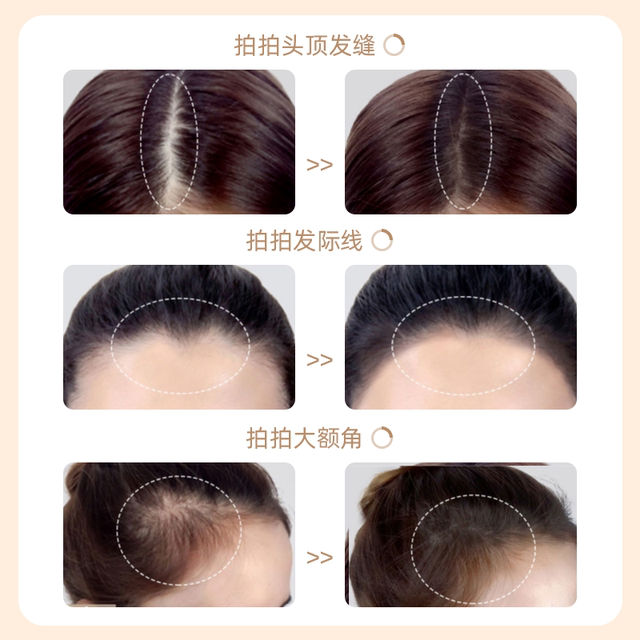 发际线粉填充神器补发高额头哑光立体修容稀疏缝密修饰鬓角初学者