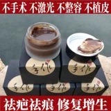 增生疤烧伤疤手术疤烫疤创伤疤