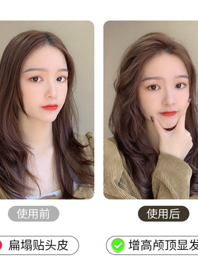 磐玲蓬松夹高颅顶头顶发根