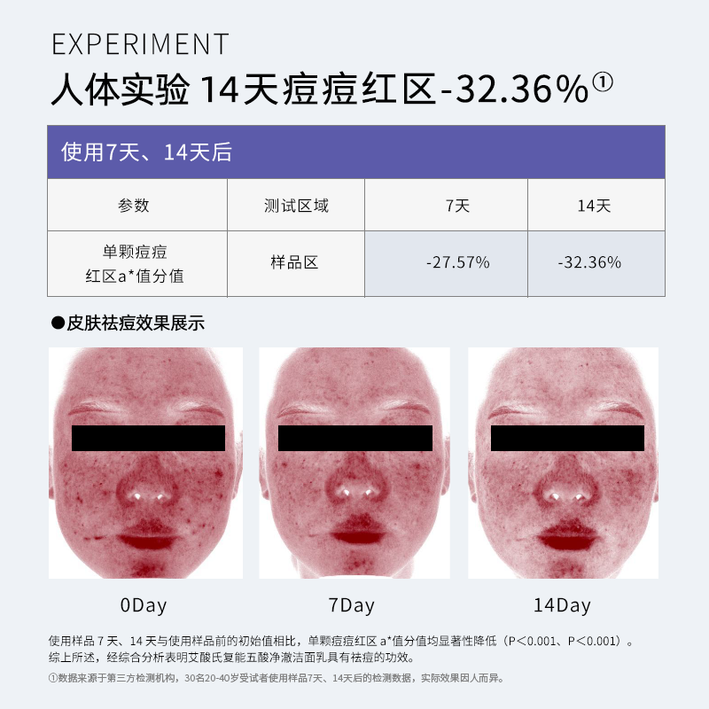 艾酸氏 五酸净澈洁面乳4.0水杨酸果酸祛痘清爽去油氨基酸洗面奶