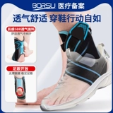 Повреждение голеностопного соединения