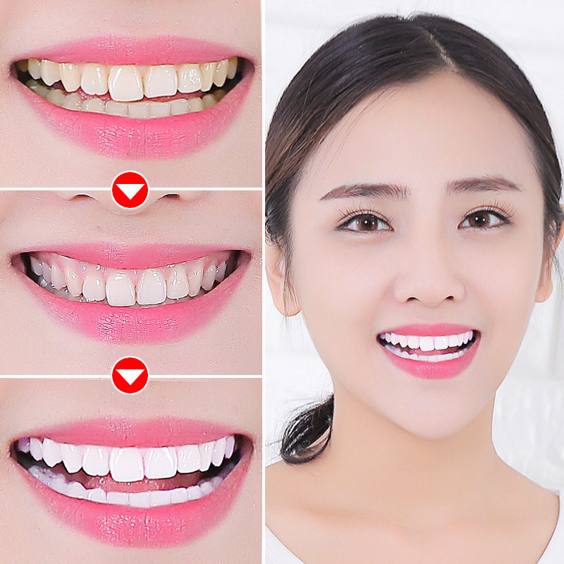 抗菌美白洗牙粉 雅惠思牙粉