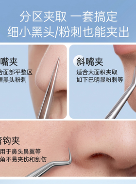 高精密超细去黑头粉刺镊套装