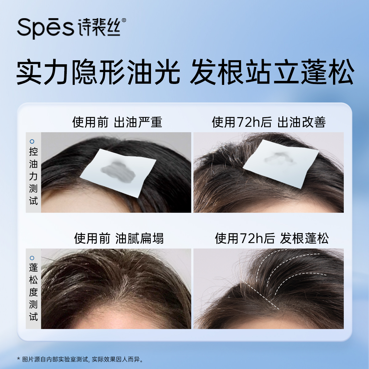 Spes诗裴丝洗发水洗发露洗头膏控油蓬松去屑止痒男女洗护套装去油
