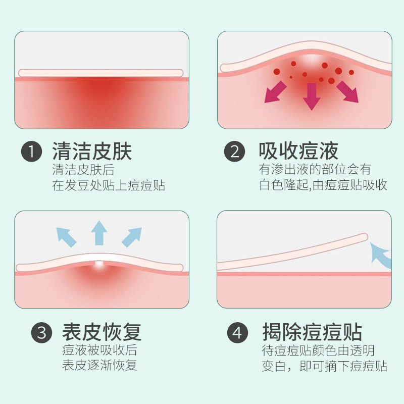 弘生医用水胶体敷料痘痘痕创口贴人工皮伤口创可贴可上妆净痘隐贴_虎窝淘