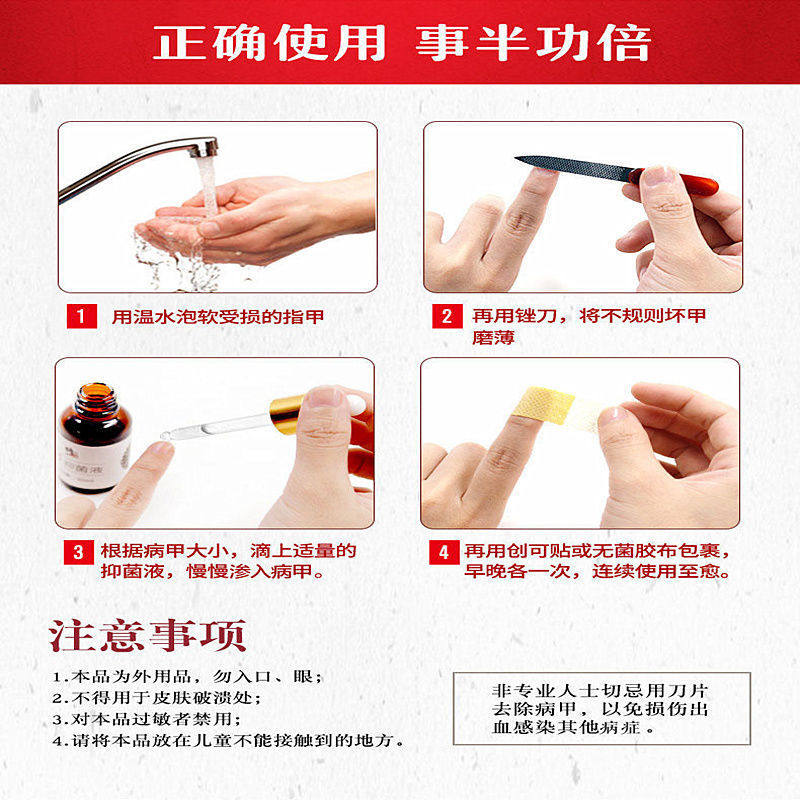 修正脱甲膏去旗舰店灰指甲专用液 卡提鸟保健用品保健理疗
