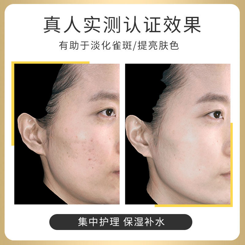 miguhara美白烟酰胺补水提亮面膜 miguhara海外贴片面膜