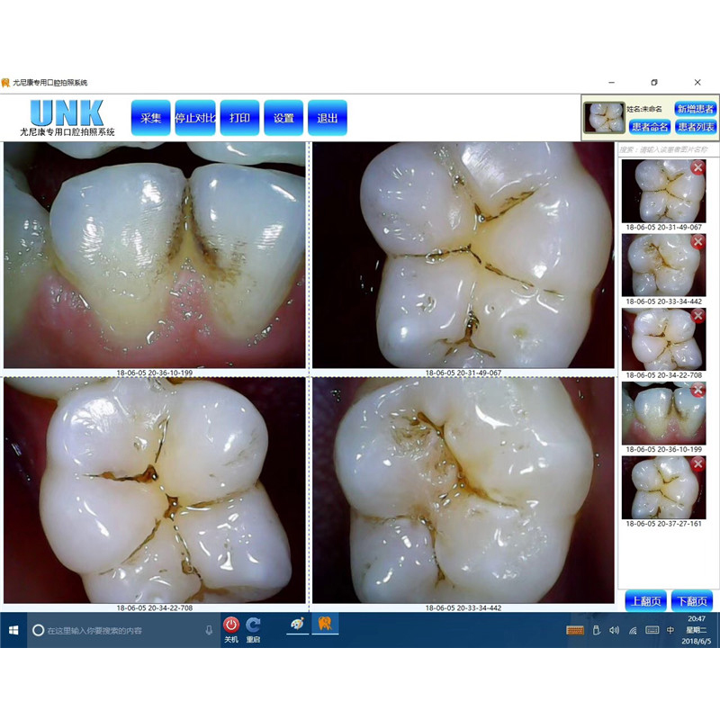 牙科口腔尤尼康内窥镜一体机电脑UNK 尤尼康内窥镜加强版 口腔科 - 图1