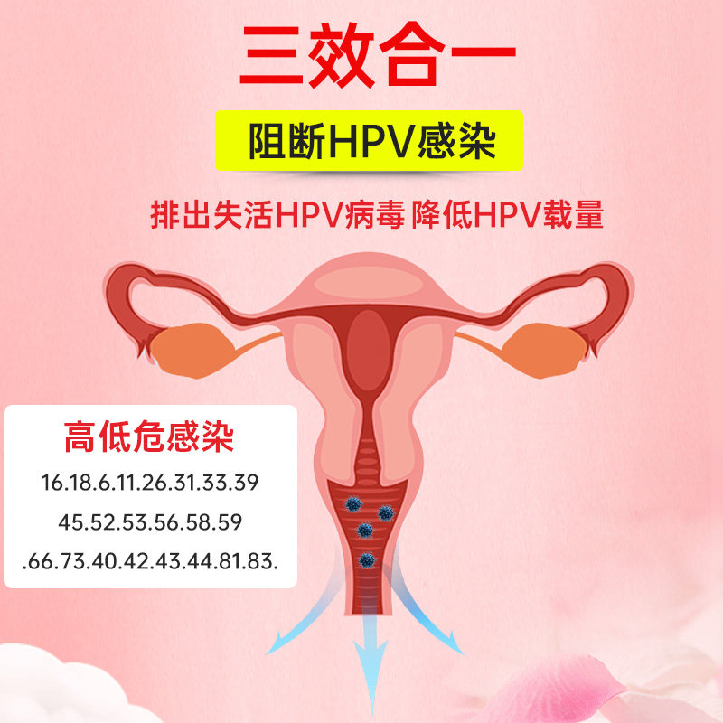 抗hpv生物蛋白敷料凝胶干扰素 雄杰医疗器械私处护理（器械）