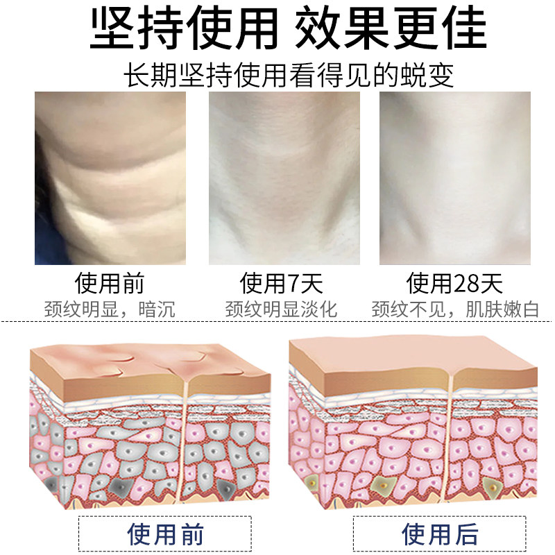 【小红书推荐】别让颈纹远离颈纹颈霜 花草传奇颈霜