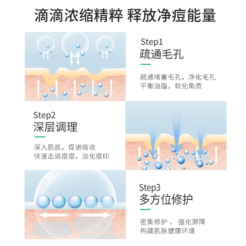 苗老祖官方正品肌底精华液修护母液改善受损肌肤面部液态精华祛痘