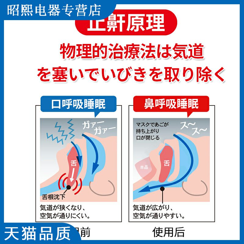 止鼻鼾带 新人首单立减十元 21年7月 淘宝海外