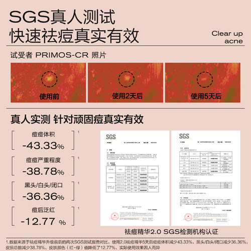 【国际名模丹妮】大水滴3点祛痘精华2.0紧急祛痘水杨酸淡化红印 - 图1