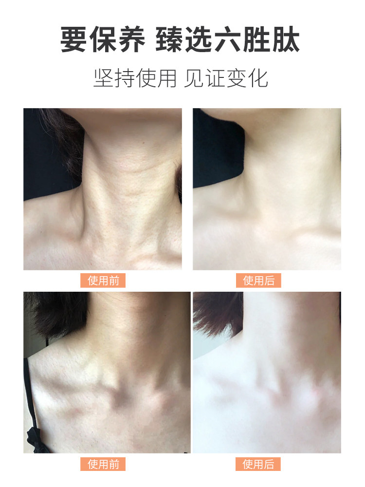 推荐别让颈纹暴露了你的年龄天鹅颈 aniyahh颈霜