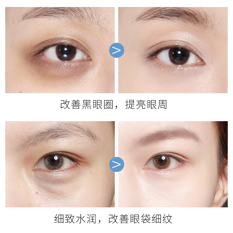  形象美广州眼膜