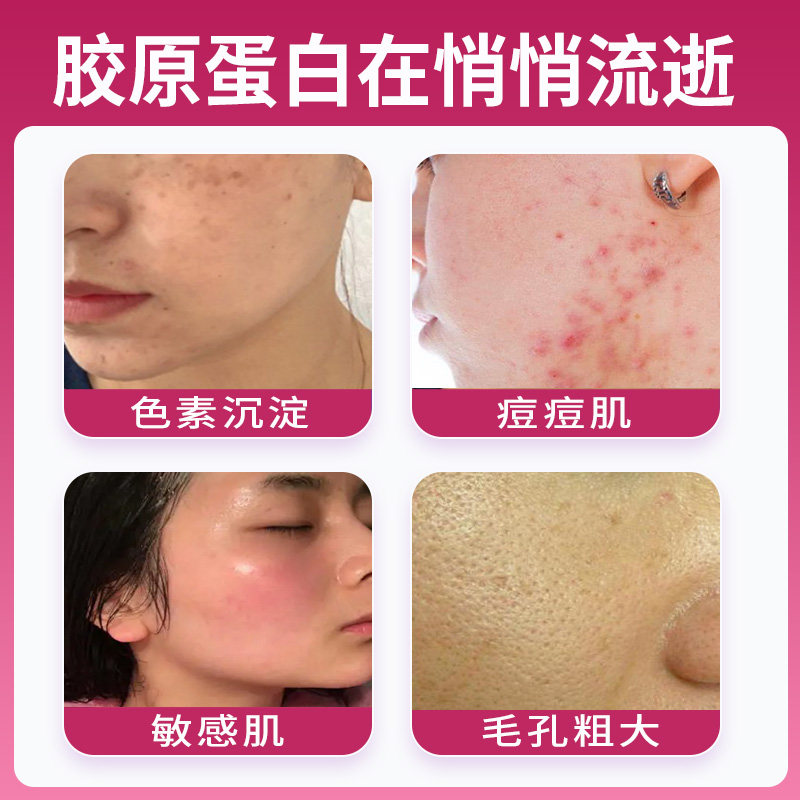 阿胶燕窝片抗美颜衰阿胶胶原蛋白肽 麟德堂胶原蛋白