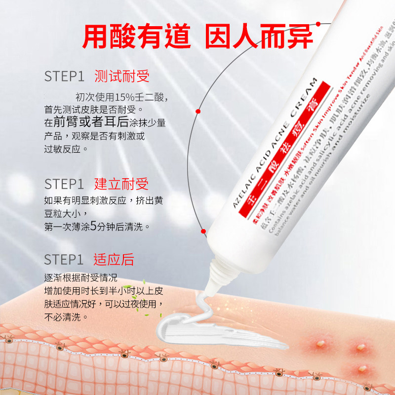 复合壬二酸15%祛痘控油官方凝胶 rydeen乳液/面霜