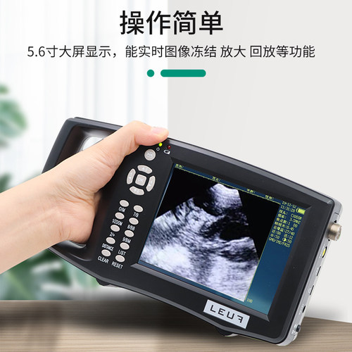 牧多多牛用B超机牛马用彩超测孕仪兽用b超便携式检孕仪直肠探头 - 图1