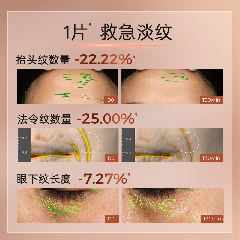 肌侣大师灌肤面膜抗皱提拉v脸紧致淡纹胶原肽补水保湿敏感肌